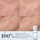 Medik8 Press & Clear before and after results on blemish-prone skin
