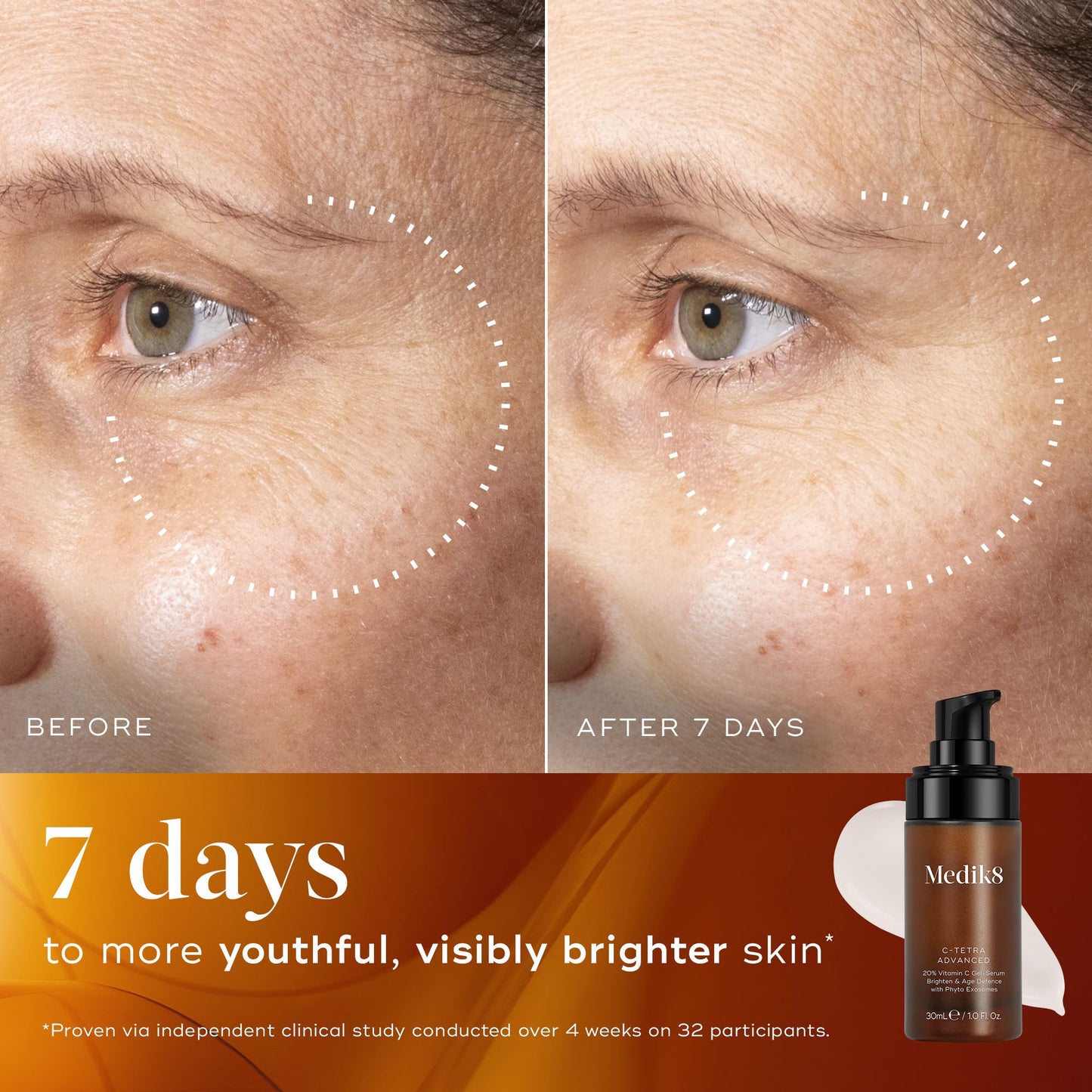 Medik8 C-Tetra Advanced 30ml before and after brighter skin in 7 days