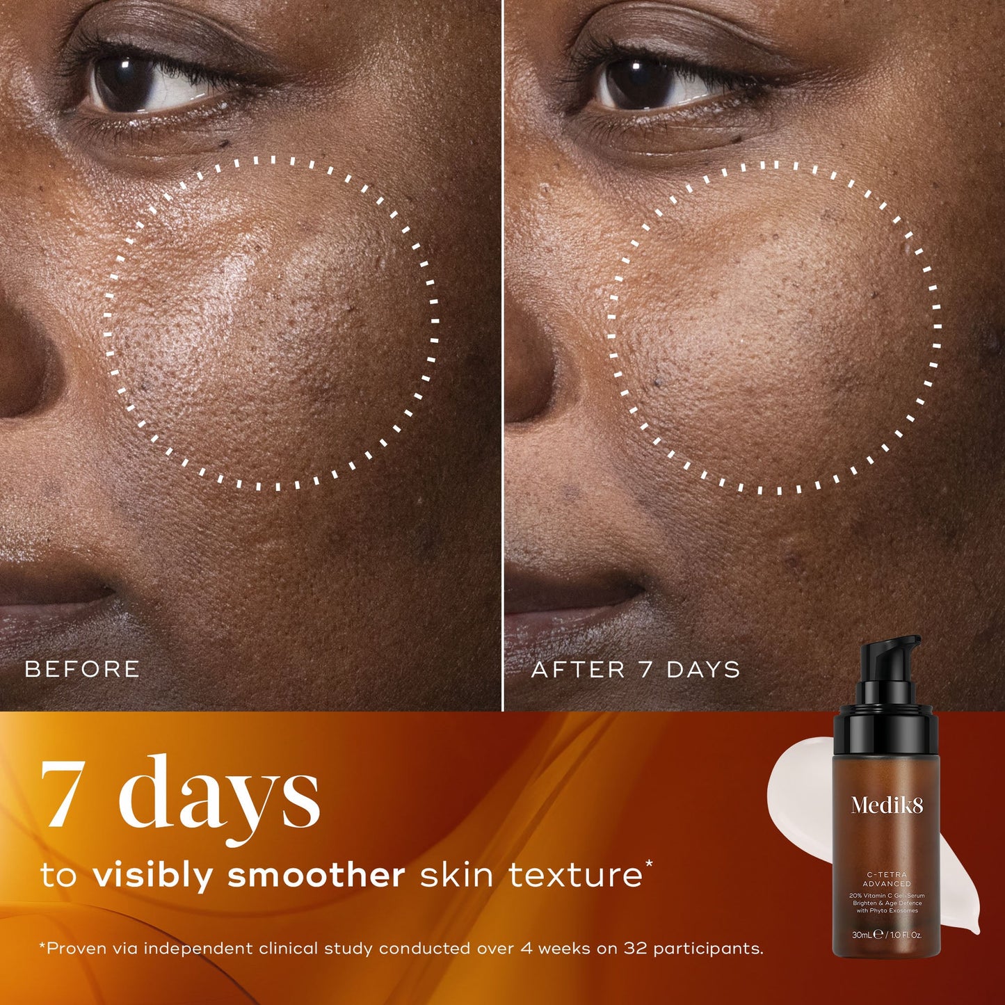 Medik8 C-Tetra Advanced 30ml before and after smoother skin texture in 7 days