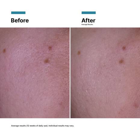 SkinCeuticals P-TIOX Cream 48ml